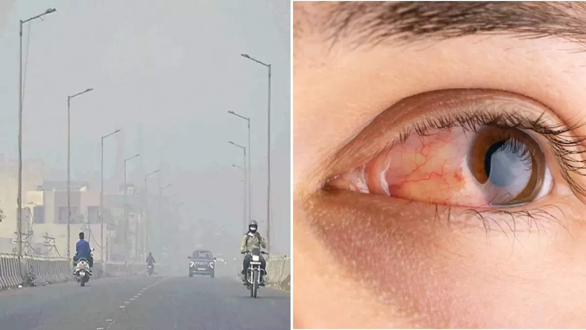 Alwar में जहरीली हवा के कारण त्वचा और आंखों में जलन के मरीज बढ़ रहे हैं