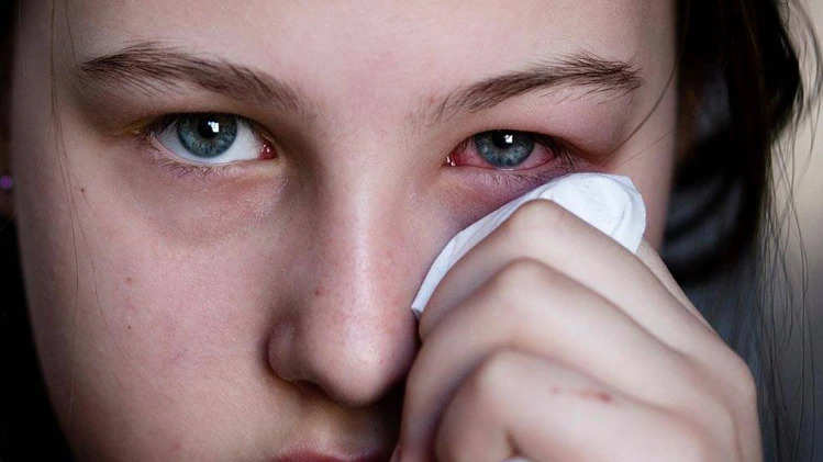Gaziabad गर्मी से आंखों में एलर्जी और सूखापन के मामले बढ़े