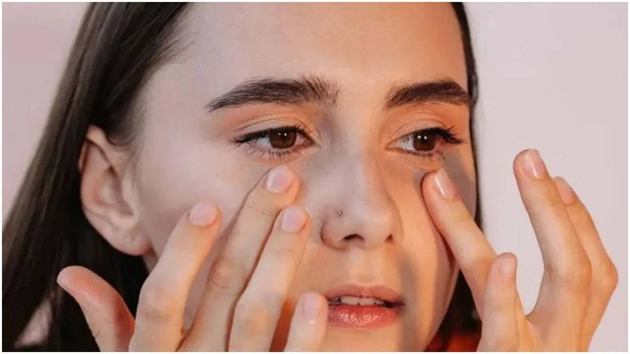 If there are dark circles on the face, then follow this method, the effect will be visible soon.