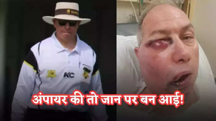 This umpire is struggling between life and death, a very painful accident happened on the cricket field, the soul will tremble after seeing it